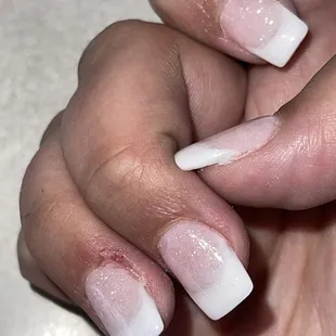 Run off dip on middle finger. Cut ring finger.