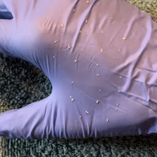 Blackhead and comedone extractions are sometimes a necessary part of treating unwanted texture and congestion. And it's so satisfying too!