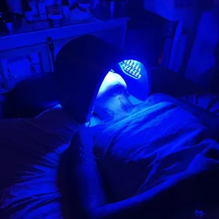 Celluma LED Treatment to control breakouts.