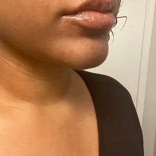 Lips