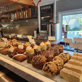 Take a look at these pastries!
