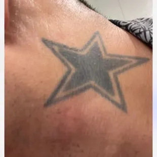 My grandkid got bitten from the bee inside the room