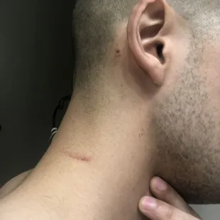 Cuts on neck/ear