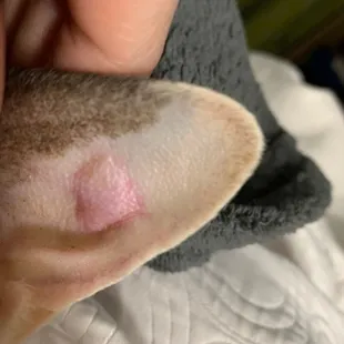 The bump Dr Pigott couldn't see