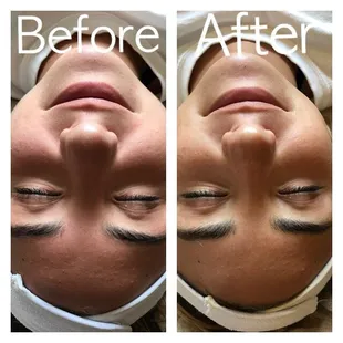 Dermaplane with Coconut Papaya Enzyme. Smooth, hydrated and glowy skin!