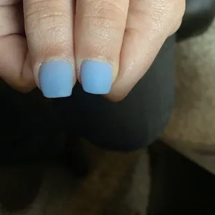 Difference in shapes in left versus right hand.