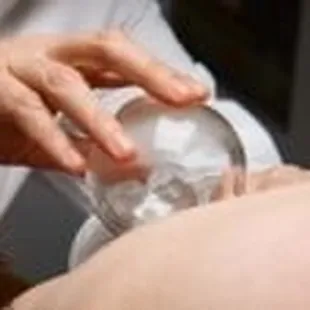 Vacuum Cupping Therapy