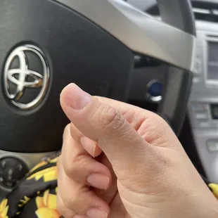 Divot on my nail from using the dermal to rough.