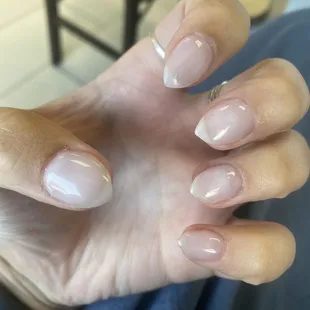 Crooked and short claws- supposed to be almond shaped.