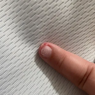 Infection