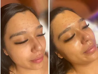 Renew Med Spa & Cryotherapy