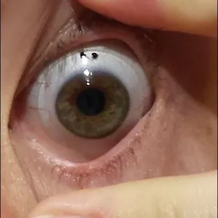 Specialized contact lens for astigmatism |  3315 Hacks Cross Rd #105 Memphis, TN 38125 |  goo.gl/Gs5VMf