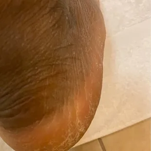 After the pedicure