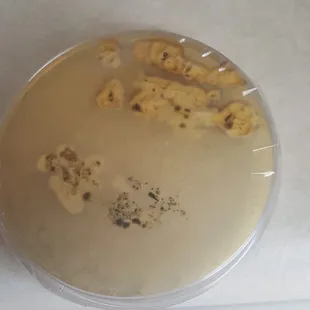 underside of mold test, it's disgusting to think anyone that came into my apartment *C07* was breathing this in.