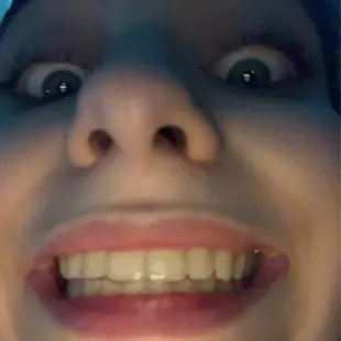 all slimes for the parking lot