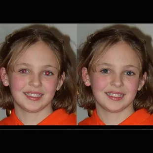 "Red eye" never needs to be a problem again