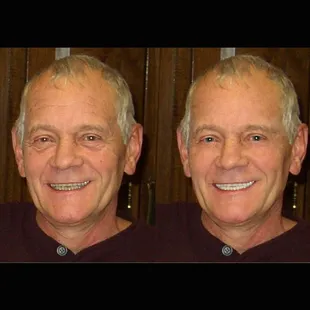 Wrinkles, brightening teeth, the occasional hair out of place -- yes, we do all of that and more