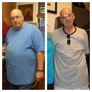 We helped Ken lose 100 pounds and he has kept it off.
