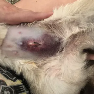 Bruising from procedure