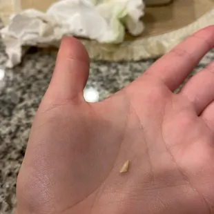 Bone shard found in burger