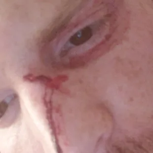 a man with a wound on his face