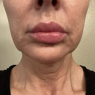 Before any treatments at this practice.