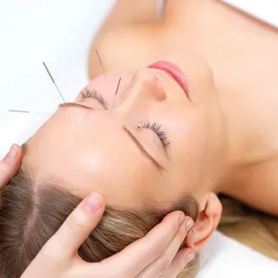 Facial acupuncture treatment