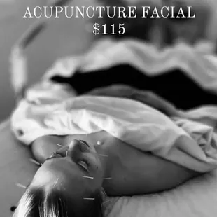 Acupuncture Facial