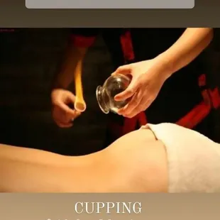 Fire cupping