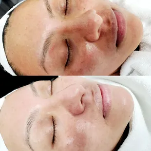 GLOWZONE  Book ur appointment for a relaxing Facial while getting healthier, younger looking skin.
