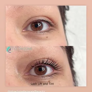Eyelash lift