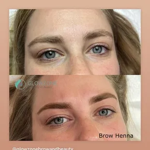 Eyelash lift