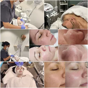 Relaxing Facials