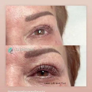 Eyelash lift