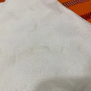 A hair that was in my lo mein