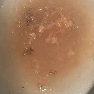 Puke after eating the food