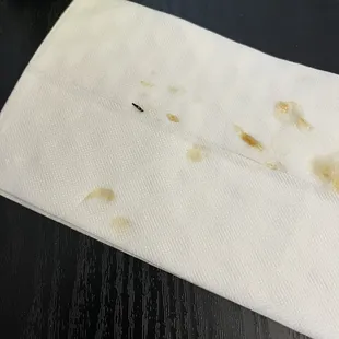 The black foreign matter is plastic that was in my Egg Foo Young combination