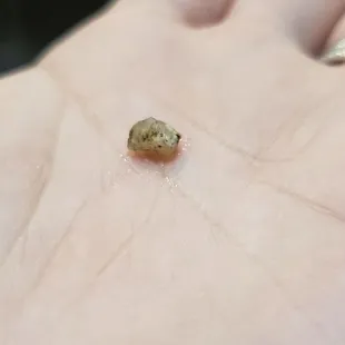 a hand with a small piece of a tiny bug on it