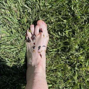 Not the prettiest feet