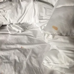 Disgusting... bedding was gross as you can see in the picture.  If you look close you will see blood that isn&apos;t just a stain.
