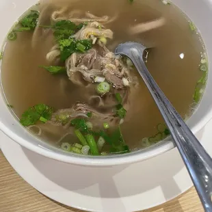 Giant Bone Broth Soup