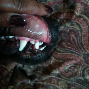 Bloody teeth