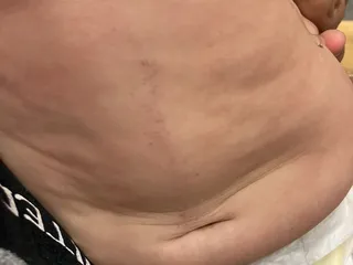 Bryan Medical Center West Campus