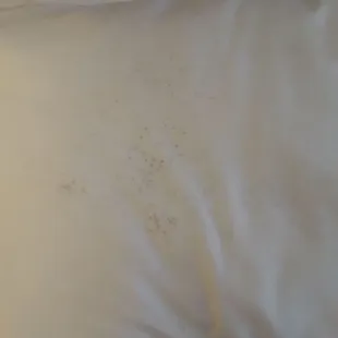 Mildew all over the pillow case