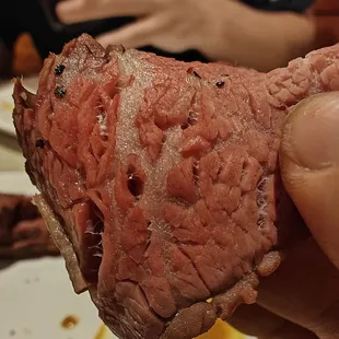 Connecting Tissue