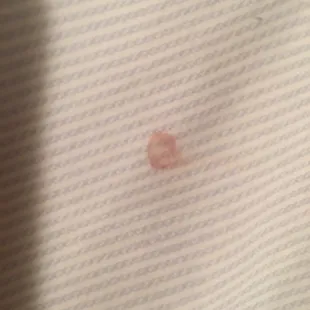 Blood stains