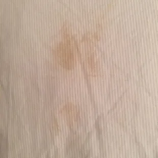 Blood stains