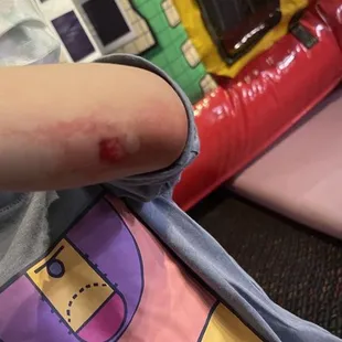 The bouncy house is not safe. It is too close to the wall and not properly inflated.