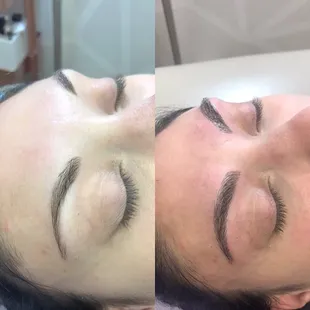 Before and after, Microblading