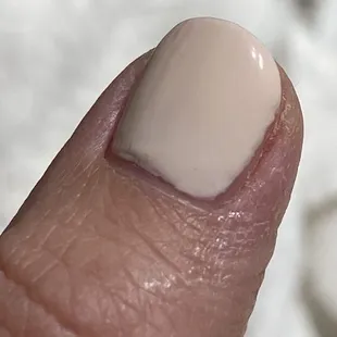 dehydrated my Skin and nails. Excess Acetone should be squeezed out of cotton ball so its not dripping down my fingers.